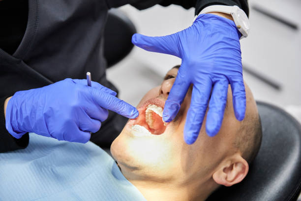 Best Emergency Treatment for Toothache in Marlboro Meadows, MD
